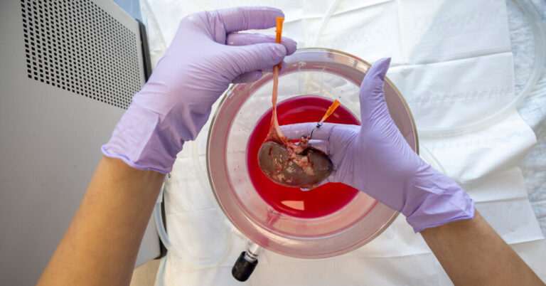 This Kidney Was Frozen for 10 Days. Could Surgeons Transplant It?