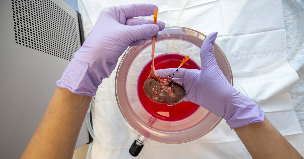 This Kidney Was Frozen for 10 Days. Could Surgeons Transplant It?