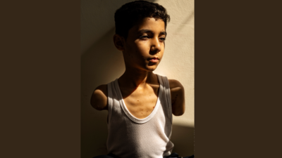 ‘How will I hug you?’: Haunting image of Palestinian boy maimed in Gaza war wins World Press Photo award