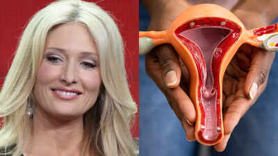 Celebrity matchmaker Amber Kelleher-Andrews dies after cancer battle: What is Ovarian Cancer and what are the early signs?