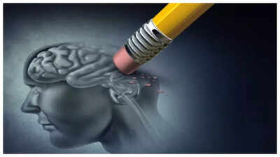 US Doctor says that doing THIS can prevent Alzheimer’s