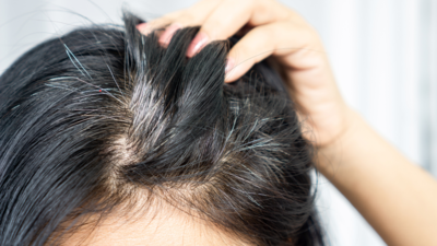 How to prevent premature greying of hair, the Ayurveda way