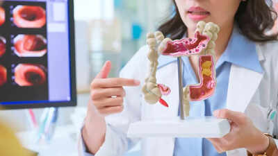 Why colon cancer deserves your attention now: Here’s what every smart adult should know