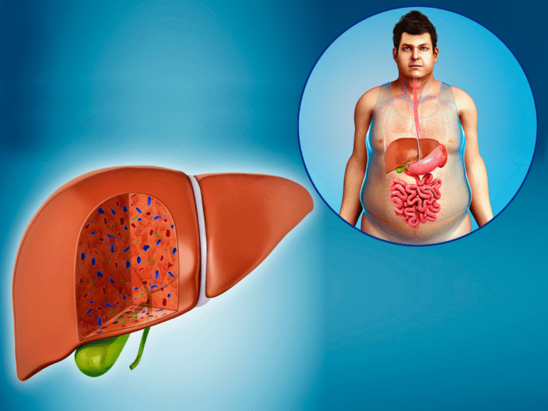 6 early symptoms signs of fatty liver
