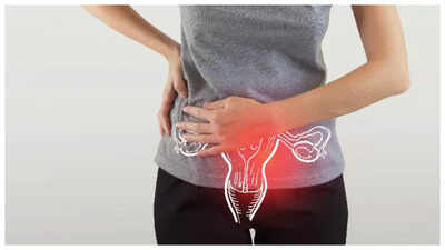 PCOS and PCOD on the rise in Indian women: Differences between the two and and symptoms to watch out for |