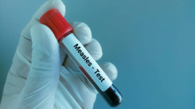 Measles in Dallas: First case confirmed in young woman who was fully vaccinated |