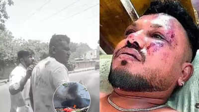 Miracle amid tragedy: Who is Viswashkumar Ramesh? lone survivor of Ahmedabad plan crash | Ahmedabad News