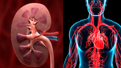 How kidney disease can raise the risk of a heart attack