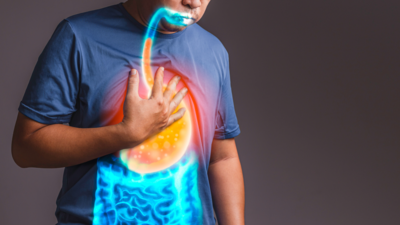 Doctor-recommended lifestyle changes to tackle acid reflux and GERD
