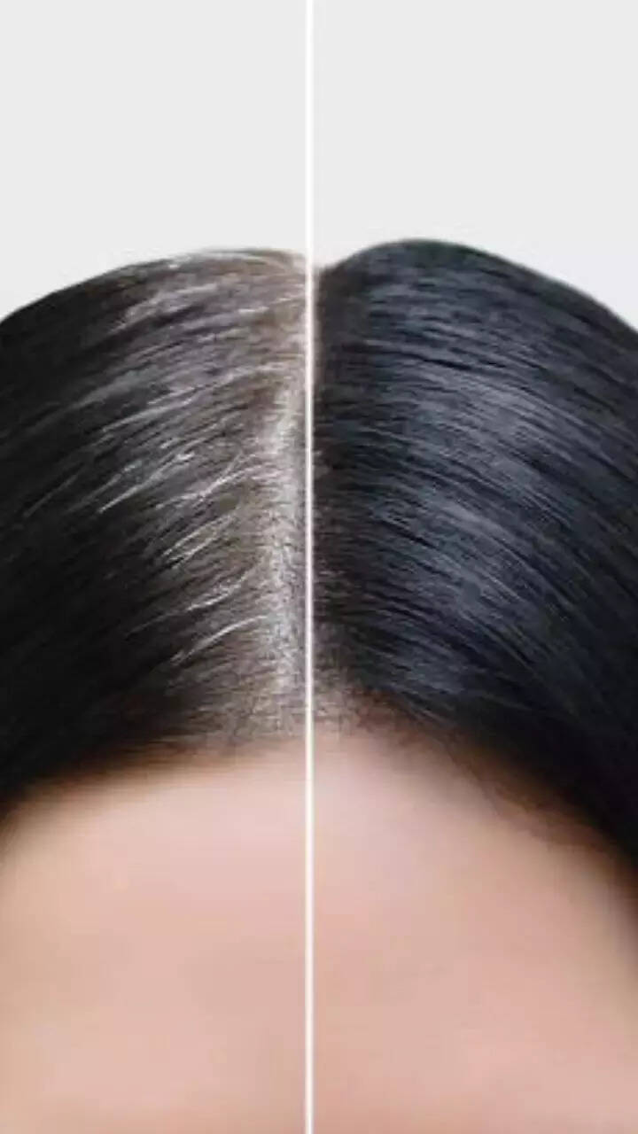 9 daily habits that can delay greying of hair