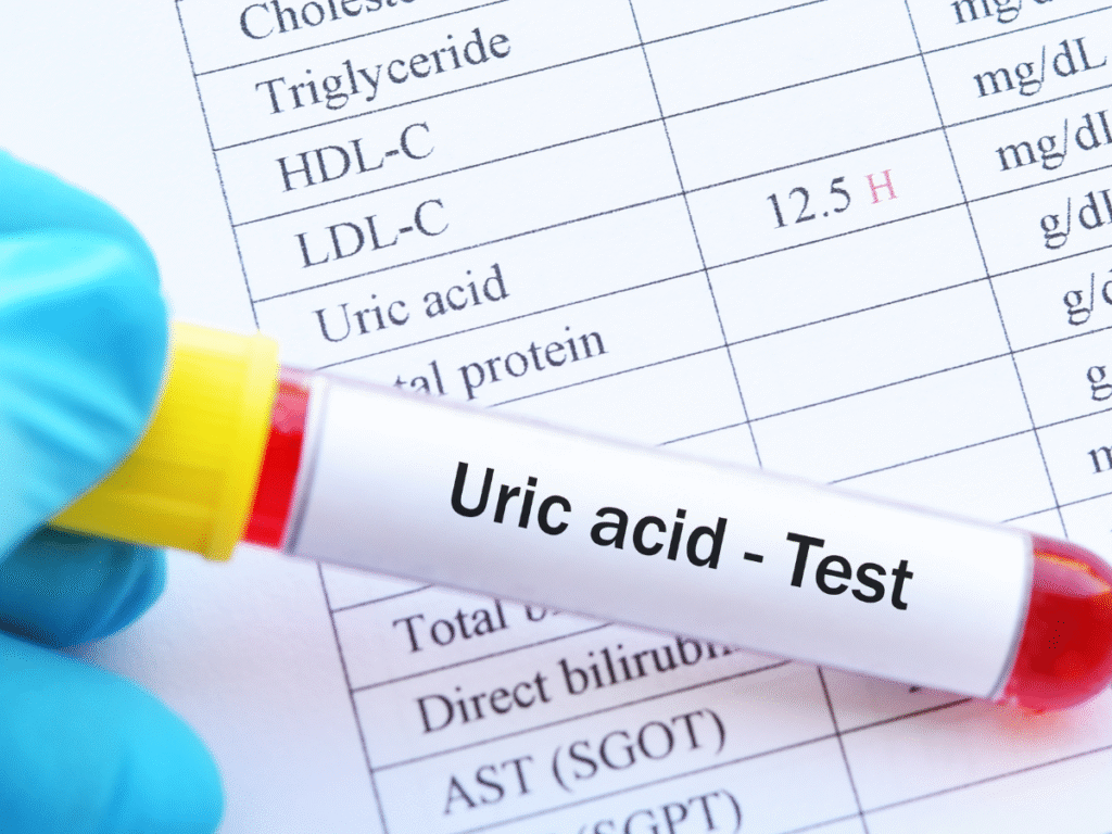6 foods to avoid if your uric acid is high