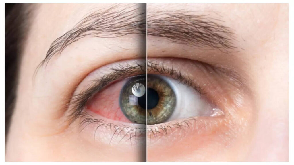 5 ways Diabetes impacts the eyes