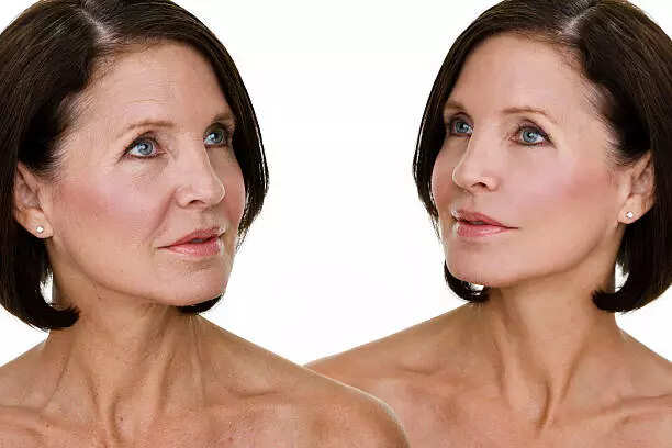 5 habits which will stop the skin of your face from sagging