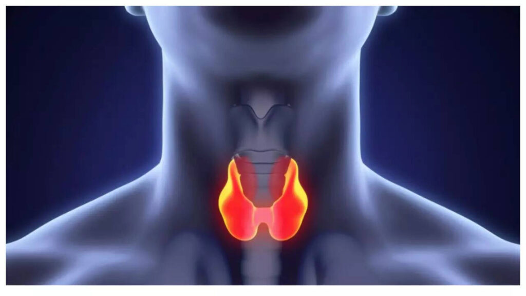5 early symptoms of Thyroid Cancer that are easy to miss