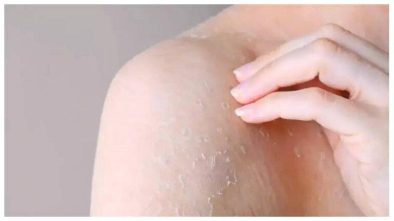 5 warning signs your skin is giving you