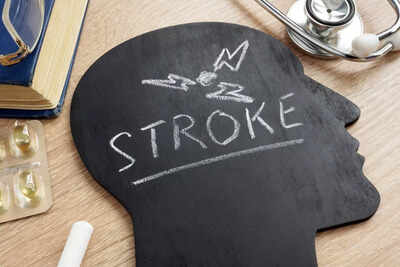 Stroke: People with THIS blood type face a higher risk of early-onset stroke |