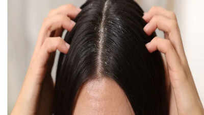 Dandruff vs Dry Scalp: What causes them, and how to choose the right treatment |