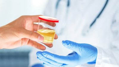 What your urine colour says about your health |