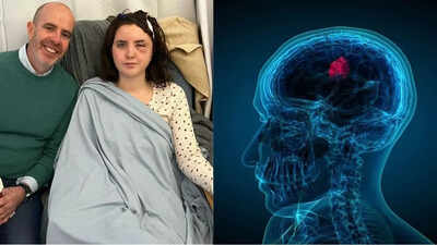 A woman’s brain tumour was mistaken for heatstroke: What you need to know about gliomas, its symptoms and causes |