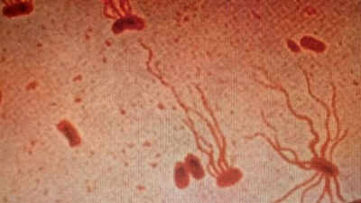 Ancient killer drug-resistant typhoid strains is becoming untreatable and spreading across the globe; study warns |