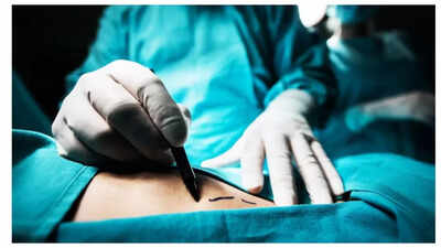 Bariatric Surgery: UP woman passes away after weight loss surgery: Know what happened, and why the procedure can be risky |