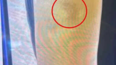 ‘Biglaw biter’: Sidley Austin fires summer intern who started biting co-workers, HR representative