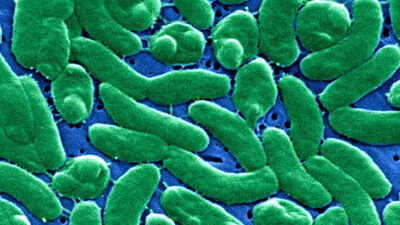 Rare flesh-eating bacteria kills 4 in Florida: Here’s what you need to know about Vibrio vulnificus | World News