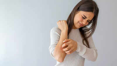 Top US doc reveals 4 skin changes that could mean liver disease |