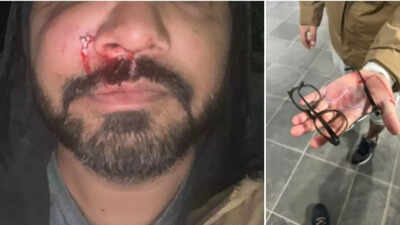 ‘Leaving me bleeding on the pavement’: Indian-origin AI scientist Santosh Yadav attacked in Dublin, says it’s not an isolated incident