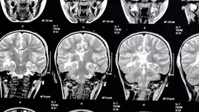 THIS silent threat around is eating away at the brain, even increasing the risk of dementia |