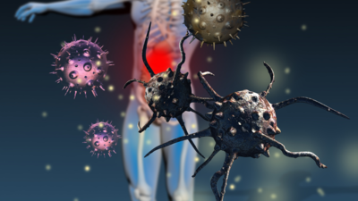 7 factors that may trigger autoimmune diseases