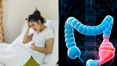 5 key reasons colon cancer is rising among young people; and ways to prevent |