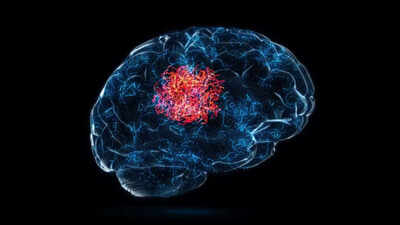 How a suspected flu led to a brain tumour diagnosis for a 26-year-old man: Don’t ignore headaches, fatigue, and other warning signs |