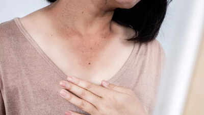 Dark Neck Home Remedies: 8 home remedies to get rid of dark neck naturally |