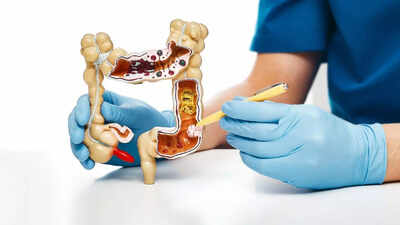 Why some colon cancers resist treatment: Understanding oncofetal reprogramming what did scientists discover |