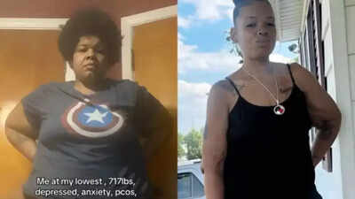 From 325 kg to 166 kg: How a correct diagnosis after years of misjudgment changed this woman’s life |