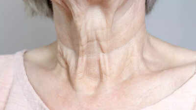 10 natural and simple remedies to treat neck wrinkles at home |