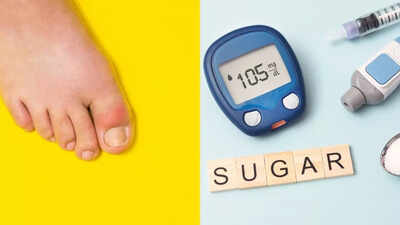 How gout increases your risk of developing type 2 diabetes: Know the link between the two |