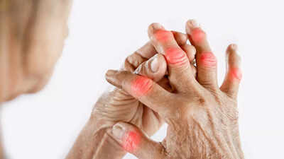 High uric acid levels in fingers and hands: Know its symptoms and ways to prevent |