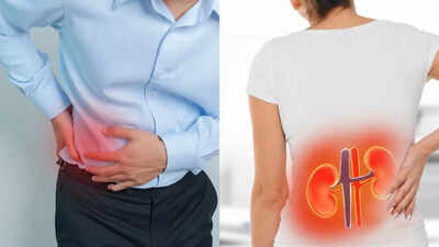 Kidney stone pain in women vs men: Differences in symptoms and areas affected |