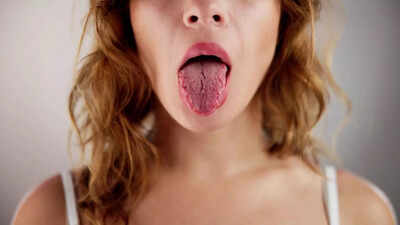 Tongue cancer warning signs: Sores, swallowing difficulties, and unusual lumps |