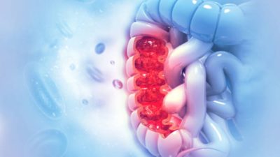Colon cancer on the rise among youngsters: 5 warning symptoms that should not be ignored |