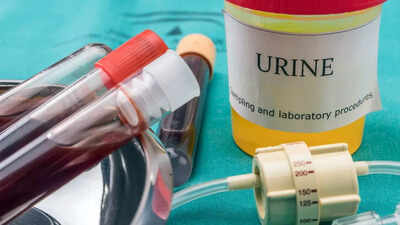 What a urine test reveals about your health: Early signs of kidney disease, diabetes, infections, and other problems |