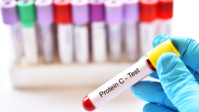What does a high C-reactive protein (CRP) level in the body mean, how does it affect us, and how can we lower it?