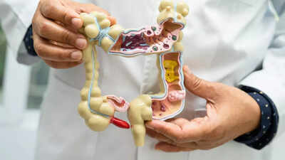 Appendix cancer on the rise: Understanding symptoms, causes, types, and more |