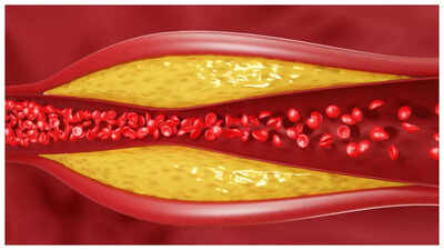 HDL vs LDL vs Triglycerides: How to optimally manage each form of Cholesterol |