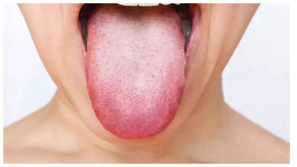5 warning health signs that the tongue reveals!