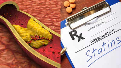 Are Cholesterol reducing drugs safe? 5 things to know about them