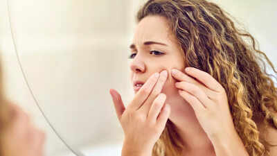 Popping a pimple in THIS area of the face can paralyze you, doc warns |