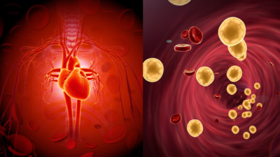 The shocking truth about ‘normal’ cholesterol and heart attacks, according to longevity specialist